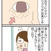 ホットフラッシュで顔にブツブツができた話①