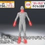 【注意】30～40代の新型コロナ感染者、脳梗塞になる可能性があると発表！　『コロナのつま先』と呼ばれる「しもやけ」に似た赤い斑点が前兆か