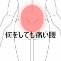 2か月続く腰痛が椅子を持ち上げて悪化したぎっくり腰  　登別室蘭すのさき鍼灸整骨院　症例報告