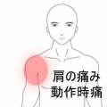 右手で左肩を触ると筋張った痛みが走る右肩前側の症状　登別室蘭すのさき鍼灸整骨院　症例報告