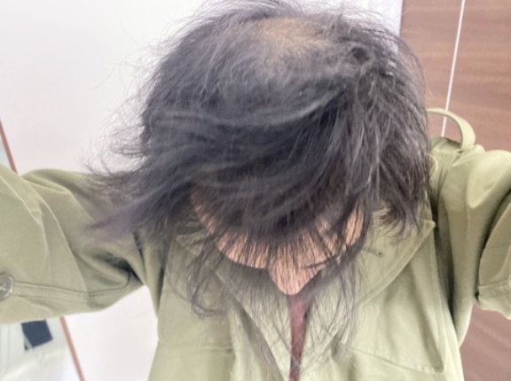 【画像】最近の弱者男性の髪型、全部これｗｗｗｗｗ