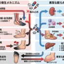 「抗生物質と痛み止めの乱用が、足を壊死させて膨張させる恐怖の現実」