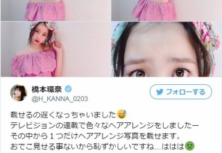 橋本環奈の“おでこ全開”ショットに反響ｗｗｗｗｗｗｗｗｗｗｗｗ