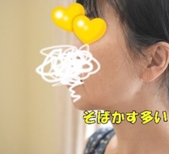 【50代のシミ取り体験】美容皮膚科で顔のシミをレーザー治療！物価高なのに今は驚くほど安い✨