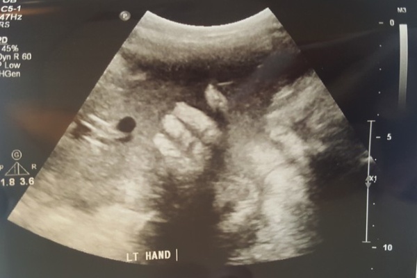 専業主婦のつぶやき In Usa 妊娠後期 ２７ ４０週