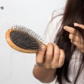 頭が強い場合はどうすればいいですか?いくつかのタイプの一般的な脱毛状態、対症療法および回復は、個人的な収集を強くお勧めします