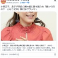 【芸能】小原正子、息子が奈良公園の鹿に顔を蹴られ「鼻から目の下　山なり足形」　顔に跡がクッキリ