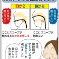 人生初！胃カメラレポ②必要なもの