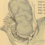 絶対に遠慮したい昔の"恐ろしい治療法"13選