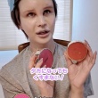 【驚愕】Matt、「顎が3cm伸びた」！ヒアルロン酸で顔面変化した写真公開が話題に