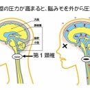 静脈洞