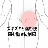 『重量物で起きたズキズキ腰痛で靴下が履けない　登別室蘭すのさき鍼灸整骨院　症例報告』の画像