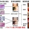 バセドウ病による目の変化「甲状腺眼症」の治療が進化していた！