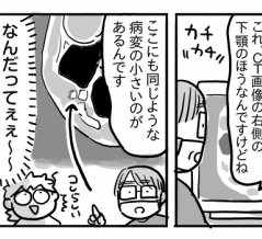 親知らずを抜こうと思っただけなのに㉔【腫瘍がもう一つ？】