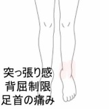 『1年前の捻挫後から続く左足首の突っ張り感と背屈制限　登別室蘭すのさき鍼灸整骨院　症例報告』の画像