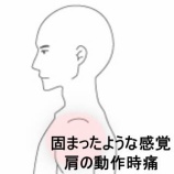 『左肩が固まったような感覚で動かすと痛む肩関節周囲炎 　登別室蘭すのさき鍼灸整骨院　症例報告』の画像