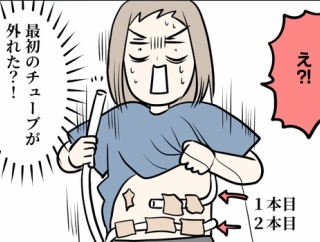 オランダで入院した話【１４６ー２】１本目のチューブ