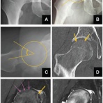 スポーツ整形外科医S. Uのブログ  Sports Physician  S.U Blog