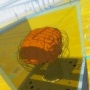 【衝撃画像】歯と脳がどれだけ密接に関係があるか、一目でわかる画像がこちら！　→　」虫歯を放置しておくととんでもない事に…」