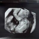 それぞれの卒業式