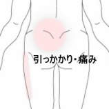 『腰と臀部の引っかかる痛みから脚の痛みへ 　登別室蘭すのさき鍼灸整骨院　症例報告』の画像