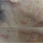 こどもの病気・おとなの病気