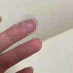 「ここ数日、左目がずっと見えづらくてモヤモヤしてる。なんだろ？」 → 衝撃の原因が判明ｗｗｗｗｗ