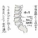 脊髄くも膜下麻酔