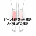 つま先立ちができないふくらはぎの張りと痛み　登別室蘭すのさき鍼灸整骨院　症例報告