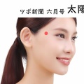 【太陽】片頭痛