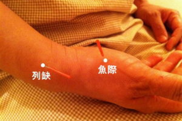 鍼灸師のツボ日記 12年08月