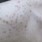livedoor