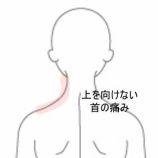 『上を向けない、後ろを向けない左後頚部の刺すような痛み 登別室蘭すのさき鍼灸整骨院 症例報告』の画像