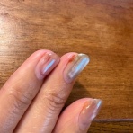 私が体験した抗がん剤の副作用の覚書と対策