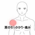 ベンチプレスで右肩関節奥に引っ掛かり感がある症状 　登別室蘭すのさき鍼灸整骨院　症例報告