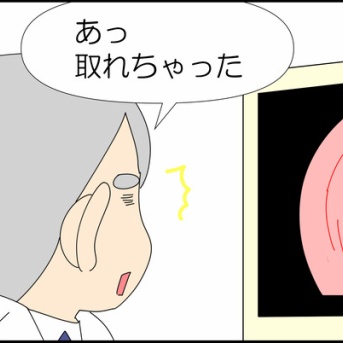 ポリープさん、どこですか⑤