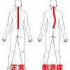 背骨が曲がっている！