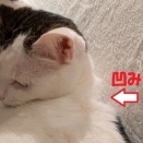 手術痕