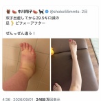 【悲報】X民「しょこたん！それうちの足や～～！」万バス ➞中川翔子「だからxって嫌」