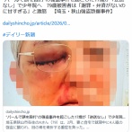 【埼玉・狭山強盗致傷事件】バールで頭を殴打の強盗事件起こした17歳「逆送なし」で少年院へ　79歳被害者「謝罪・弁済がないのに甘すぎ」