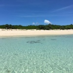 アラフォー女子、脂肪吸引体験記だよ