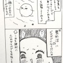 脂肪吸引後のいま