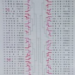 ソフトテニス 勝手録