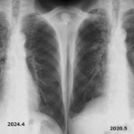 こどもの病気・おとなの病気
