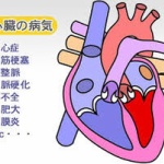 重い心臓病を患う男児(1)の両親、募金募る