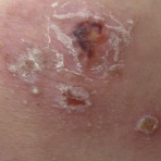 こどもの病気・おとなの病気