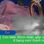 【動画あり】ベトナム男性が激しい腹痛で入院 → 体内から「生きたウナギ」が摘出される…こうなった原因について男性は何も語らず