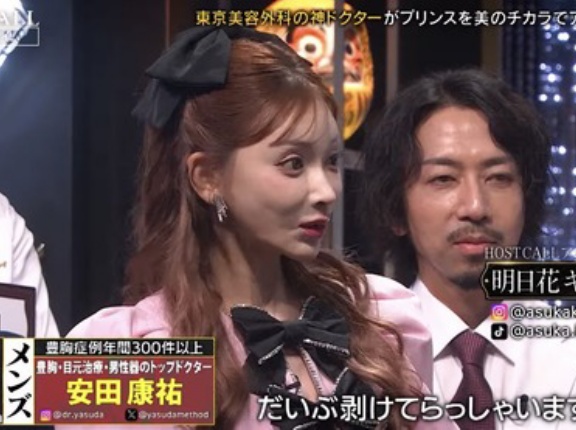 明日花キララさん　また顔が変わって大丈夫か心配されてしまう