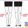 O脚とガニ股は違う