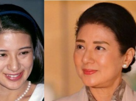 美しい年齢の重ね方
